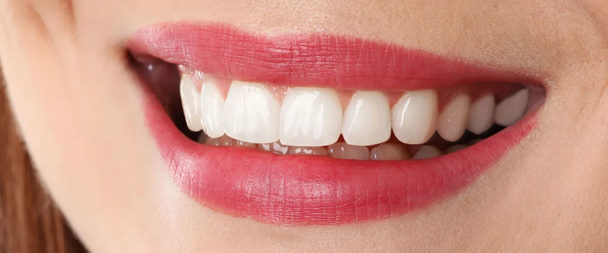 dental-after