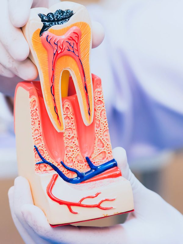 dental-img17