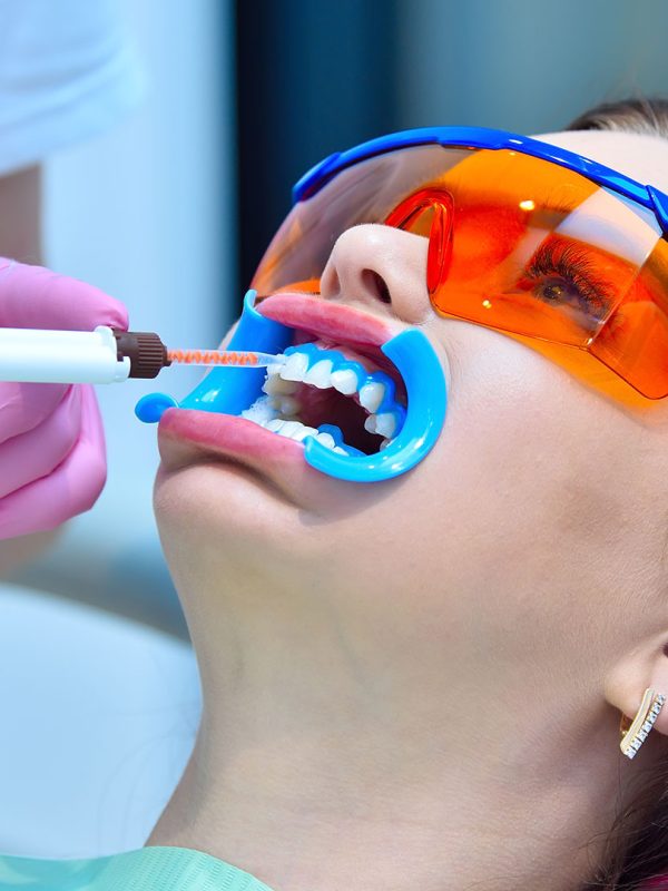 dental-img18