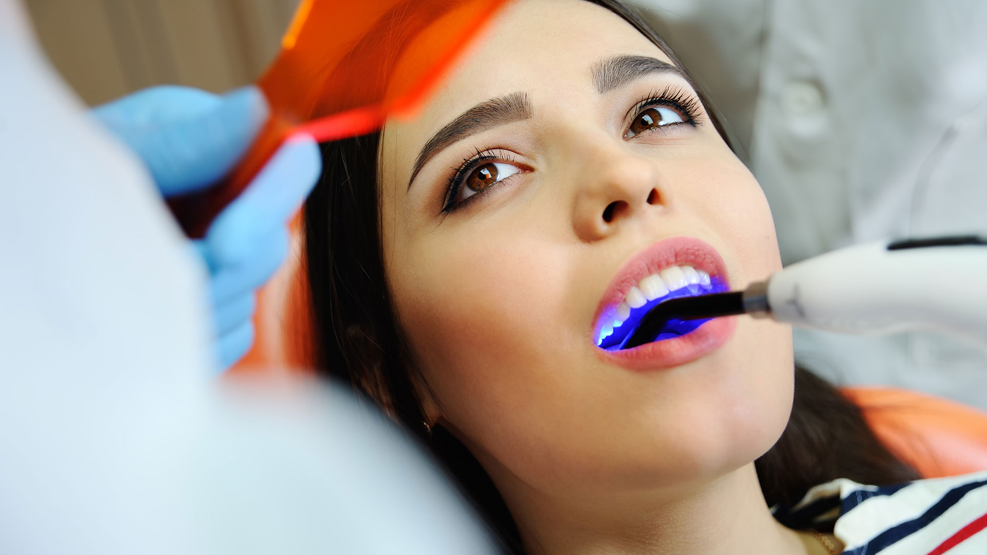 dental-img2